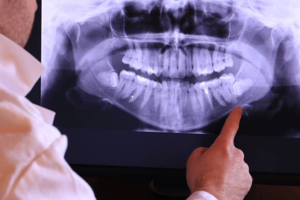 Best Chipped Tooth Repair Near Me  in Wilder, ID