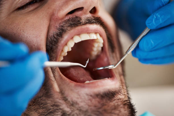 Best Dentist for Tooth Abscess  in Wilder, ID